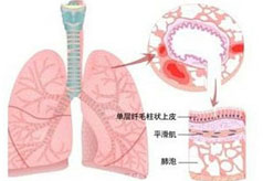咳嗽变异性哮喘的病因有哪些
